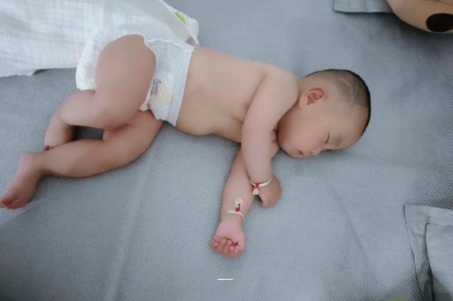 铜仁宝宝上火有眼屎
